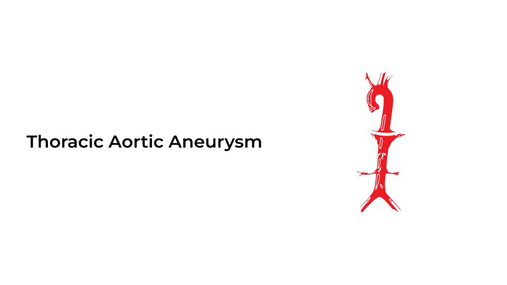 Thoracic-Aortic-Aneurysm